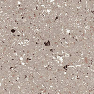 Textured Medusa Gray